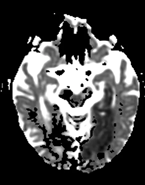 Exame - Neurorradiologia - Dra. Fernanda Rueda_2