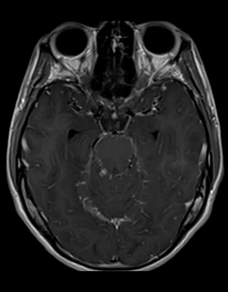 Exame - Neurorradiologia - Dra. Fernanda Rueda_3