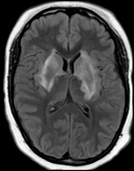Exame - Neurorradiologia - Dra. Fernanda Rueda_4