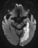 Exame - Neurorradiologia - Dra. Fernanda Rueda_1