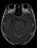 Exame - Neurorradiologia - Dra. Fernanda Rueda_3